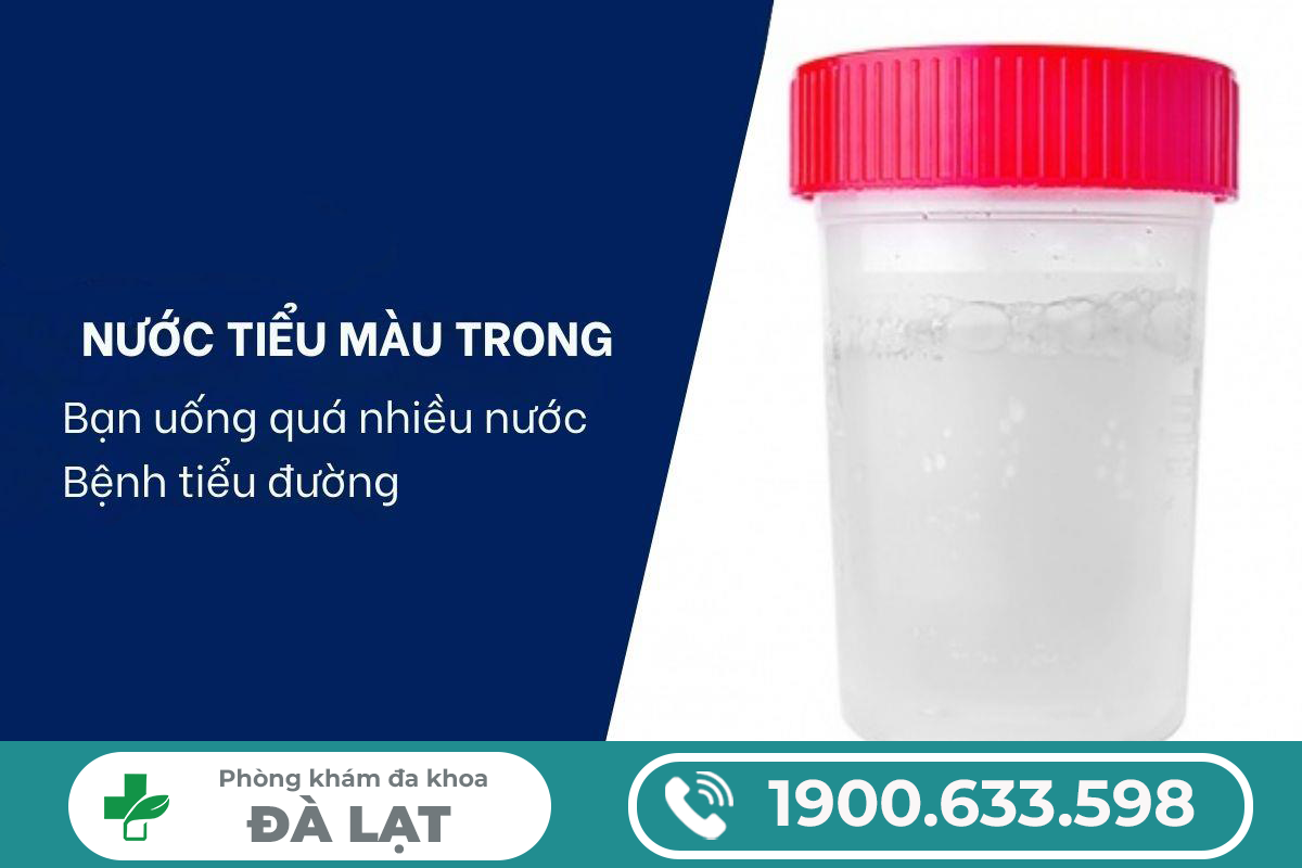 Hình ảnh minh họa